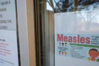 Amerika Laporkan Kematian Pertama akibat Campak di West Texas