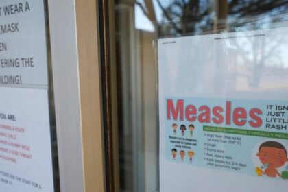 Amerika Laporkan Kematian Pertama akibat Campak di West Texas