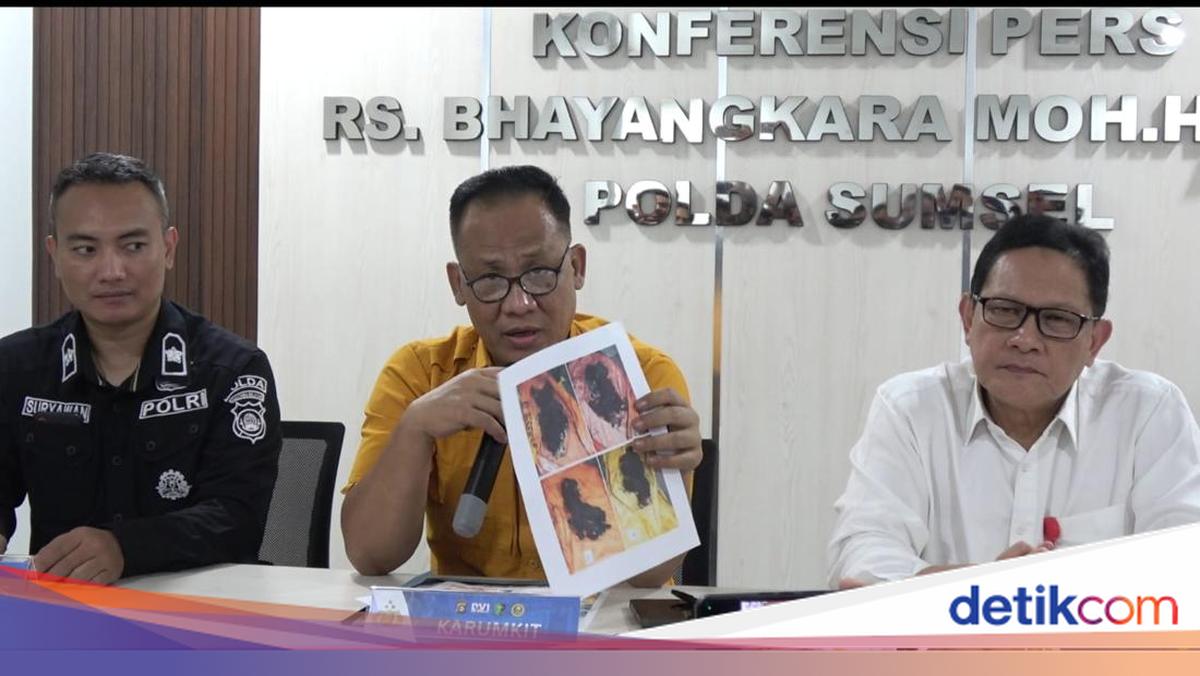 Korban Tewas Bus ALS di Sumsel Mencapai 18 Orang