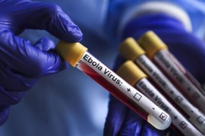 AS Pasang Alat Uji Ebola di Bandara Jelang Piala Dunia