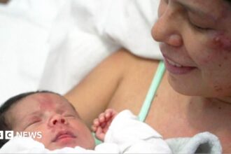 Ibu dan Bayi Selamat dari Puing Gempa Venezuela Berkat Semangat Bertahan