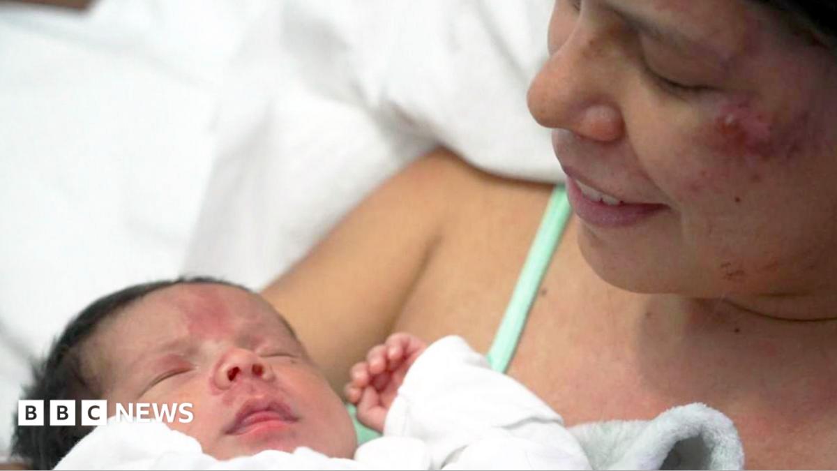 Ibu dan Bayi Selamat dari Puing Gempa Venezuela Berkat Semangat Bertahan