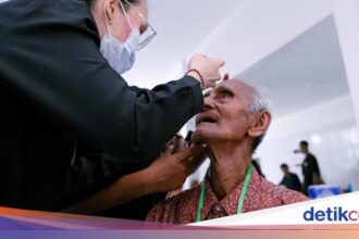 Operasi Katarak Gratis untuk Ratusan Lansia di NTT pada HLUN 2026