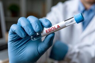 Perancis Umumkan Kasus Pertama Ebola dari Dokter Misi Kemanusiaan