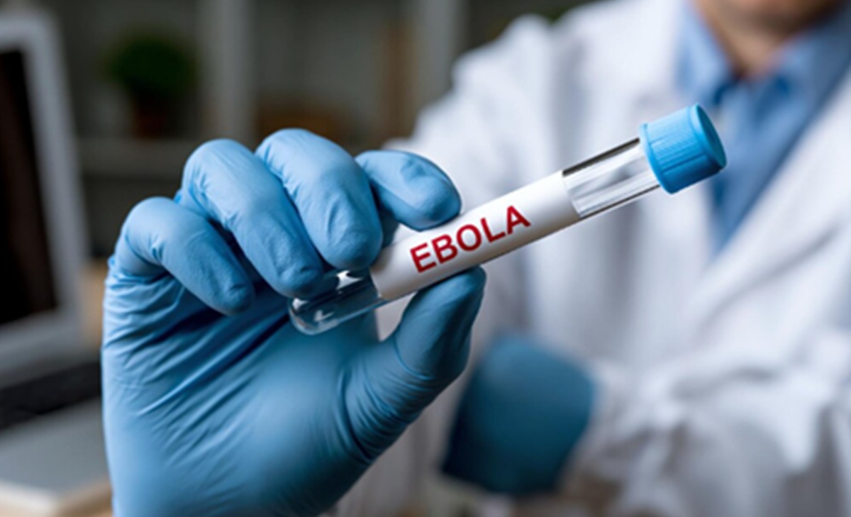 Perancis Umumkan Kasus Pertama Ebola dari Dokter Misi Kemanusiaan