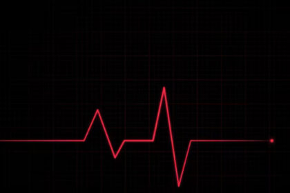 Penjelasan Medis Mengapa Kebisingan Membuat Jantung Berdebar
